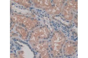 Used in DAB staining on fromalin fixed paraffin- embedded kidney tissue (Rhotekin Antikörper  (AA 309-416))