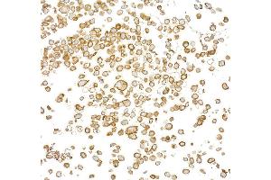 Immunocytochemistry (ICC) image for anti-Epidermal Growth Factor Receptor (EGFR) (C-Term) antibody (ABIN7795642) (Rekombinanter EGFR Antikörper  (C-Term))