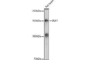 Western blot analysis of extracts of Rat brain, using ULK1 antibody (ABIN6134005, ABIN6149921, ABIN6149922 and ABIN6224624) at 1:500 dilution. (ULK1 Antikörper  (AA 400-499))