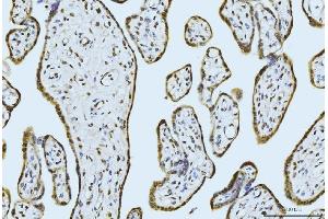IHC analysis of MOV10 using anti-MOV10 antibody (ABIN7600236). (MOV10 Antikörper  (AA 167-772))