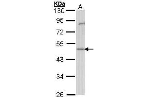 WB Image Sample (30 ug of whole cell lysate) A: Hep G2 , 10% SDS PAGE antibody diluted at 1:1000 (GDI1 Antikörper)