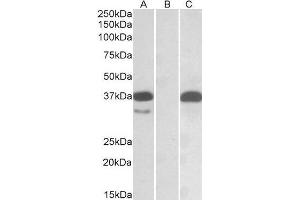 Western Blotting (WB) image for Proto-Oncogene Pim-2 (Serine Threonine Kinase) (PIM2) (Internal Region) peptide (ABIN369570) (Proto-Oncogene Pim-2 (Serine Threonine Kinase) (PIM2) (Internal Region) Peptid)
