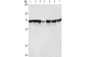 Western blot analysis of Hela cells HT29 cells human fetal liver tissue Human testis tissue 231 cells K562 cells human bladder transitional cell carcinoma tissue using LMNB1 Polyclonal Antibody at dilution of 1:750 (Lamin B1 Antikörper)