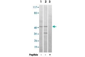 Western blot analysis of extracts from HeLa cells (Lane 1) and Jurkat cells (Lane 2 and lane 3), using MYLIP polyclonal antibody . (MYLIP Antikörper)