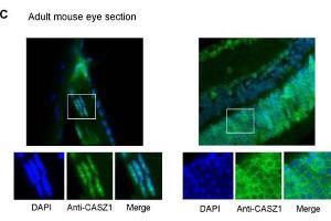 Immunofluorescence of Rabbit anti-CASZ1 Antibody. (CASZ1 Antikörper  (Internal Region))