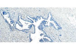 (ABIN185182) Negative Control showing staining of paraffin embedded Human Prostate, with no primary antibody. (VPS35 Antikörper  (C-Term))