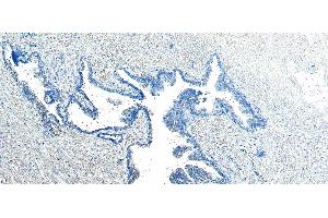 (ABIN185182) Negative Control showing staining of paraffin embedded Human Prostate, with no primary antibody. (VPS35 Antikörper  (C-Term))