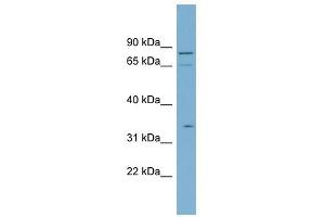SLC5A9 antibody used at 1 ug/ml to detect target protein.