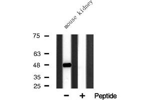 Western Blotting (WB) image for anti-Histone Deacetylase 3 (HDAC3) (C-Term) antibody (ABIN6262179)