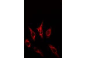 ABIN6274613 staining HepG2 cells by IF/ICC. (CCRL1 Antikörper  (C-Term))