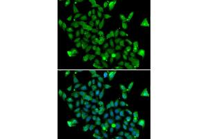 Immunofluorescence analysis of MCF-7 cells using ASPA antibody (ABIN6127373, ABIN6137211, ABIN6137212 and ABIN6223094). (ASPA Antikörper  (AA 1-313))