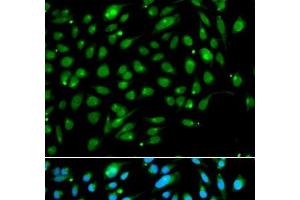 Immunofluorescence analysis of A549 cells using ING3 Polyclonal Antibody (ING3 Antikörper)