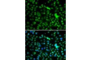 Immunofluorescence analysis of MCF-7 cells using NSUN6 antibody (ABIN6132426, ABIN6144879, ABIN6144881 and ABIN6217457). (NSUN6 Antikörper  (AA 220-469))