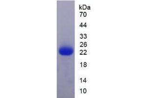 Image no. 1 for Cytochrome C Oxidase Subunit IV Isoform 1 (COX4I1) (AA 1-169) protein (His tag) (ABIN6237415) (COX IV Protein (AA 1-169) (His tag))