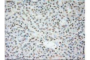 Immunohistochemistry (IHC) image for anti-Cardiac Troponin I (TNNI3) (AA 1-210) antibody (ABIN1490609) (TNNI3 Antikörper  (AA 1-210))