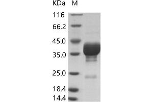 Western Blotting (WB) image for Coxsackie Virus A16 VP4 (Cox A16 VP4) protein (Fc Tag) (ABIN7198888) (Cox A16 VP4 Protein (Fc Tag))