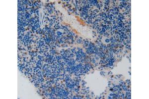 Used in DAB staining on fromalin fixed paraffin- embedded spleen tissue (PAI1 Antikörper  (AA 141-389))