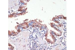 Immunohistochemistry of paraffin-embedded Rat lung using MSI1 Polyclonal Antibody at dilution of 1:200 (40x lens). (MSI1 Antikörper)