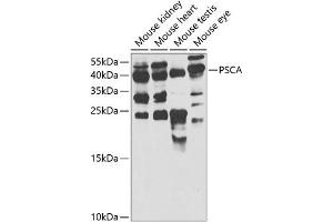Western blot analysis of extracts of various cell lines, using PSCA antibody  at 1:1000 dilution. (PSCA Antikörper  (AA 12-114))