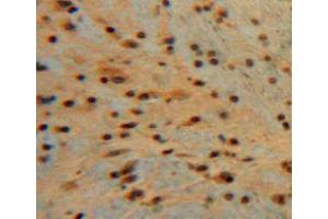 Used in DAB staining on fromalin fixed paraffin-embedded brain tissue (Midkine Antikörper  (AA 22-140))