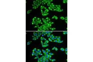 Immunofluorescence analysis of HeLa cells using DDX3X antibody (ABIN5973285). (DDX3X Antikörper)