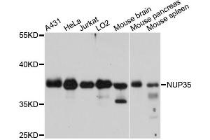 Western blot analysis of extracts of various cell lines, using NUP35 antibody. (NUP35 Antikörper)
