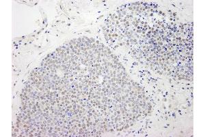 Immunohistochemistry (IHC) image for anti-Chemokine (C-C Motif) Ligand 2 (CCL2) (AA 25-100) antibody (ABIN7448645)