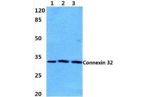 Western blot analysis of Connexin 32 (L115) Antibody at 1/500 dilution:  Lane 1: Hela cell lysate. (GJB1 Antikörper)