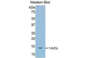 Western blot analysis of the recombinant protein. (IL1R1 Antikörper  (AA 226-318))