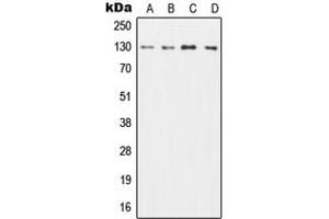 Western blot analysis of CD131 expression in HL60 (A), TF1 (B), SP2/0 (C), H9C2 (D) whole cell lysates. (CD131 Antikörper  (C-Term))