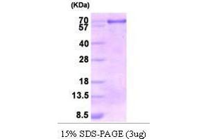 Figure annotation denotes ug of protein loaded and % gel used. (Calnexin (CANX) (AA 21-481) Peptid)