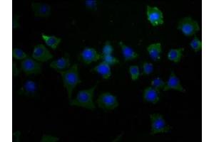 Immunofluorescence staining of SH-SY5Y cells with ABIN7163961 at 1:50, counter-stained with DAPI. (Kv2.1/KCNB1 Antikörper  (AA 535-765))