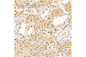 Immunohistochemistry of paraffin-embedded mouse kidney using UBB Rabbit pAb (ABIN6130181, ABIN6149775, ABIN6149776 and ABIN6222958) at dilution of 1:200 (40x lens). (UBASH3B Antikörper  (AA 1-300))