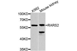 Western blot analysis of extracts of various cell lines, using RARS2 antibody (ABIN5974692) at 1/1000 dilution. (RARS2 Antikörper)