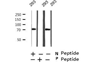 Western blot analysis on 293 cell lysate using Phospho-RIPK2(Ser176) Antibody (RIPK2 Antikörper  (pSer176))