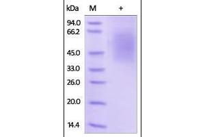 Human Fc epsilon RI alpha, His Tag on SDS-PAGE under reducing (R) condition.