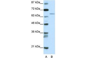 WB Suggested Anti-RFX5 Antibody Titration:  2. (RFX5 Antikörper  (N-Term))