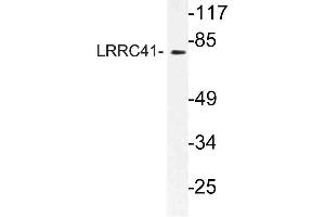 Western blot (WB) analysis of LRRC41 antibody in extracts from rat heart cells. (LRRC41 Antikörper)