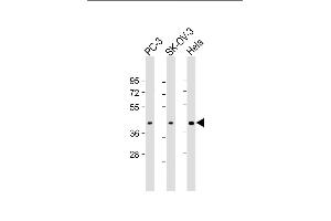 All lanes : Anti-ST3GAL4 Antibody (N-Term) at 1:1000-1:2000 dilution Lane 1: PC-3 whole cell lysate Lane 2: SK-OV-3 whole cell lysate Lane 3: Hela whole cell lysate Lysates/proteins at 20 μg per lane. (ST3GAL4 Antikörper  (AA 26-57))