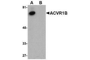 Western blot analysis of ACVR1B in human kidney tissue lysate with AP30015PU-N ACVR1B antibody at 1 μg/ml in (A) the absence and (B) the presence of blocking peptide. (Activin A Receptor Type IB/ALK-4 Antikörper  (C-Term))