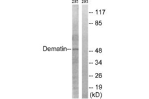 Immunohistochemistry analysis of paraffin-embedded human heart tissue using Dematin (Ab-403) antibody. (Dematin Antikörper  (Ser403))