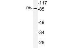 Western blot analysis of Rb antibody in extracts from HeLa cells. (Retinoblastoma 1 Antikörper)