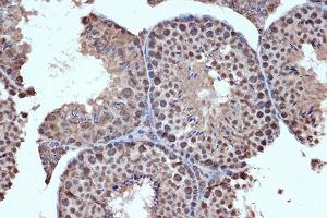 Immunohistochemistry of paraffin-embedded mouse testis using HD Rabbit mAb (ABIN7267714) at dilution of 1:100 (40x lens). (HDAC8 Antikörper)