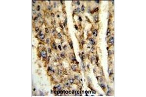 Immunohistochemistry (Paraffin-embedded Sections) (IHC (p)) image for anti-Deiodinase, Iodothyronine, Type III (DIO3) (AA 250-278), (C-Term) antibody (ABIN653482)