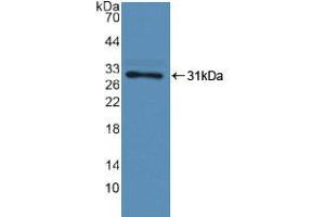 Western blot analysis of recombinant Human F13A1. (F13A1 Antikörper  (AA 107-345))