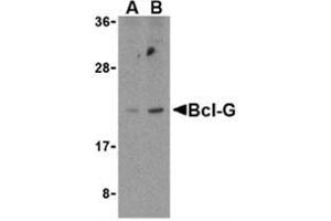 Western blot analysis of Bcl-G in U937 cell lysates with Bcl-G antibody at (A) 2. (BCL2L14 Antikörper  (C-Term))