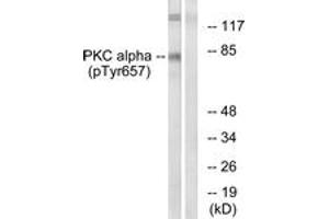 Western blot analysis of extracts from COLO205 cells, using PKC alpha (Phospho-Tyr657) Antibody. (PKC alpha Antikörper  (pTyr657))
