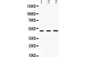 Western blot analysis of CNPase expression in rat  brain extract ( Lane 1), mouse brain extract ( Lane 2) and HELA whole cell lysates ( Lane 3).