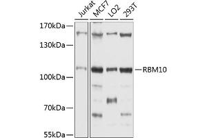 Western blot analysis of extracts of various cell lines, using RBM10 antibody (ABIN1682489, ABIN3018697, ABIN3018698 and ABIN6220546) at 1:1000 dilution. (RBM10 Antikörper  (AA 1-180))
