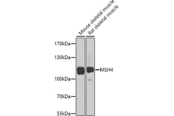 MSH4 Antikörper  (AA 697-936)